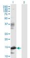 Eukaryotic Translation Initiation Factor 5A antibody, H00001984-M01, Novus Biologicals, Western Blot image 