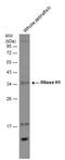 Ribonuclease H1 antibody, GTX117624, GeneTex, Western Blot image 