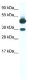 Thyroid Hormone Receptor Beta antibody, TA339055, Origene, Western Blot image 