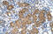 Betaine--Homocysteine S-Methyltransferase antibody, ARP41474_T100, Aviva Systems Biology, Immunohistochemistry paraffin image 