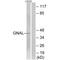 G Protein Subunit Alpha L antibody, A09404, Boster Biological Technology, Western Blot image 