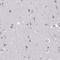 Centrosomal Protein 72 antibody, NBP2-34103, Novus Biologicals, Immunohistochemistry frozen image 