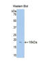 Complement Factor B antibody, LS-C294087, Lifespan Biosciences, Western Blot image 