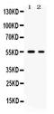 Solute Carrier Family 2 Member 5 antibody, PB9960, Boster Biological Technology, Western Blot image 