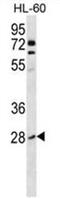 Ras Homolog Family Member B antibody, AP50230PU-N, Origene, Western Blot image 