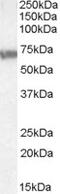 ATP Binding Cassette Subfamily D Member 4 antibody, TA305757, Origene, Western Blot image 