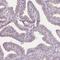 Dynein Regulatory Complex Subunit 3 antibody, NBP2-38277, Novus Biologicals, Immunohistochemistry paraffin image 