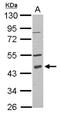 Programmed Cell Death 2 antibody, NBP2-19738, Novus Biologicals, Western Blot image 