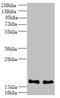 Protein Phosphatase 3 Regulatory Subunit B, Alpha antibody, A60394-100, Epigentek, Western Blot image 