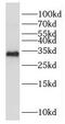 Exosome complex exonuclease RRP43 antibody, FNab02907, FineTest, Western Blot image 