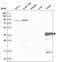 Troponin T3, Fast Skeletal Type antibody, HPA037810, Atlas Antibodies, Western Blot image 