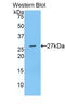 ADAM Metallopeptidase Domain 10 antibody, LS-C292559, Lifespan Biosciences, Western Blot image 