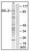 P100 antibody, AP31360PU-N, Origene, Western Blot image 
