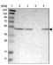 Epithelial Stromal Interaction 1 antibody, NBP1-89940, Novus Biologicals, Western Blot image 