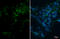 Tight Junction Protein 1 antibody, GTX636399, GeneTex, Immunocytochemistry image 