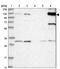 Ankyrin Repeat Domain 35 antibody, PA5-57276, Invitrogen Antibodies, Western Blot image 