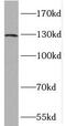 cAMP-specific 3 ,5 -cyclic phosphodiesterase 4A antibody, FNab06253, FineTest, Western Blot image 