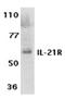Interleukin 21 Receptor antibody, A00808, Boster Biological Technology, Western Blot image 