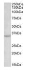 Tetraspanin 5 antibody, orb12290, Biorbyt, Western Blot image 