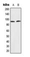 Signal Transducer And Activator Of Transcription 5A antibody, orb224181, Biorbyt, Western Blot image 