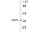 Aquaporin 5 antibody, LS-C291667, Lifespan Biosciences, Western Blot image 