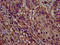 CLPTM1 Like antibody, LS-C672824, Lifespan Biosciences, Immunohistochemistry paraffin image 