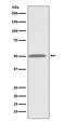 Integrin Linked Kinase antibody, M02932, Boster Biological Technology, Western Blot image 