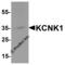 Potassium Two Pore Domain Channel Subfamily K Member 1 antibody, 8017, ProSci Inc, Western Blot image 