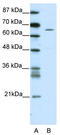 Zinc Finger Protein 205 antibody, TA343409, Origene, Western Blot image 