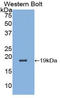 Lactalbumin Alpha antibody, LS-C292782, Lifespan Biosciences, Western Blot image 