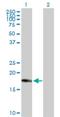 Centromere Protein M antibody, H00079019-D01P, Novus Biologicals, Western Blot image 