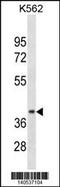 Cyclin D1 Binding Protein 1 antibody, 60-533, ProSci, Western Blot image 