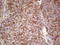 Ret Proto-Oncogene antibody, LS-C339799, Lifespan Biosciences, Immunohistochemistry paraffin image 