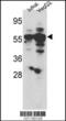 Serum/Glucocorticoid Regulated Kinase Family Member 3 antibody, 63-303, ProSci, Western Blot image 