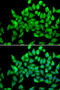 Alsin Rho Guanine Nucleotide Exchange Factor ALS2 antibody, 19-493, ProSci, Immunofluorescence image 