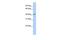 Spermatogenesis And Oogenesis Specific Basic Helix-Loop-Helix 1 antibody, GTX47531, GeneTex, Western Blot image 