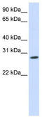 Potassium Voltage-Gated Channel Interacting Protein 4 antibody, TA337255, Origene, Western Blot image 
