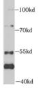 Mitogen-Activated Protein Kinase Kinase Kinase 20 antibody, FNab09581, FineTest, Western Blot image 