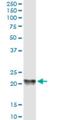 Phosphatidylethanolamine Binding Protein 1 antibody, H00005037-M01, Novus Biologicals, Western Blot image 