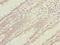 Dynein Cytoplasmic 1 Intermediate Chain 1 antibody, LS-C675675, Lifespan Biosciences, Immunohistochemistry paraffin image 