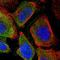 Glycogen Synthase 2 antibody, NBP1-91191, Novus Biologicals, Immunocytochemistry image 