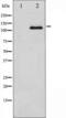 Colony Stimulating Factor 1 Receptor antibody, TA325392, Origene, Western Blot image 