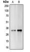 Carbonic Anhydrase 14 antibody, LS-C353356, Lifespan Biosciences, Western Blot image 