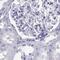 Calcium Binding Protein, Spermatid Associated 1 antibody, PA5-63114, Invitrogen Antibodies, Immunohistochemistry paraffin image 