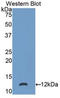 S100 Calcium Binding Protein P antibody, LS-C302234, Lifespan Biosciences, Western Blot image 