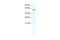 Glypican 3 antibody, 28-712, ProSci, Western Blot image 