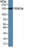 Slit Guidance Ligand 1 antibody, LS-C300245, Lifespan Biosciences, Western Blot image 