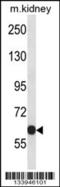 Potassium Voltage-Gated Channel Subfamily C Member 2 antibody, 57-320, ProSci, Western Blot image 