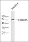 Leucine Rich Repeat Containing 15 antibody, orb101141, Biorbyt, Western Blot image 