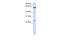 Transmembrane Protein 138 antibody, 26-201, ProSci, Enzyme Linked Immunosorbent Assay image 